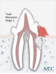 Avdc Nomenclature Avdc Org