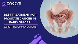 Image result for Prostate Cancer Management