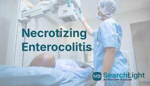 Image result for Necrotizing Enterocolitis