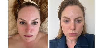 I tried 3 different facial workout treatments to see if they could sculpt  and tone my face'