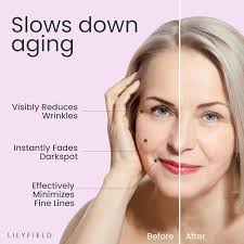 Amazon.com: LILYFIELD Wrinkle Correcting Serum with Phyto Collagen &  Vitamin C. Korean Skincare. Anti-Aging, Target Dark Spots and Fine  lines,Smoothing, All Skin Types. Korean Skin care 30ml, 1 fl. oz : Beauty