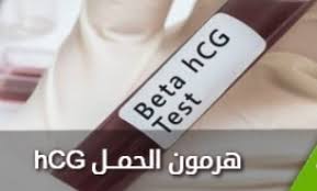 See the laboratory testing section of the varicella surveillance manual ØªØ­Ù„ÙŠÙ„ Ø§Ù„Ø­Ù…Ù„ Ø§Ù„Ø±Ù‚Ù…ÙŠ Ù…Ø®ØªØ¨Ø±Ø§Øª Ø§Ù„ØºÙŠØ« Ù„Ù„ØªØ­Ø§Ù„ÙŠÙ„ Ø§Ù„Ø·Ø¨ÙŠØ© Ù…Ø¹Ø§Ù† Facebook