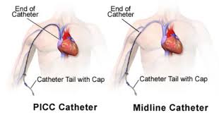 Picc Vs Midline Peripherally Inserted Central Catheters And Midline Catheters Care Catheter Nursing Cheat Oncology Nursing