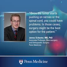 Early diagnosis and treatment of spinal cancer is essential to care. So You Have A Spinal Tumor What Are Your Options Penn Medicine