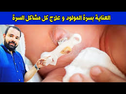 متي تسقط سرة المولود العناية بالسرة بروز السرة التهاب السرة نزيف السرة رائحة السرة الكريهة Youtube