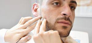 Unknown factor — individual unexplained variation in if we see we have a bad killing rate the next session we will do a patch test on your face. How Many Sessions Are Needed For Electrolysis My Beard Gang
