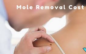 How much does body lift surgery cost in san diego? How Much Does Mole Removal Cost Affordable Mole Removal