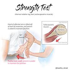 Image result for Lift-Off Subscapularis Test