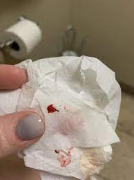 Check spelling or type a new query. Tmi Is This A Miscarriage 5 Weeks Exactly Babycenter