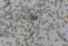 Hd amoeba at 40x 100x 200x and 400x youtube. Giardia Muris Size Giardia Oocyst Size