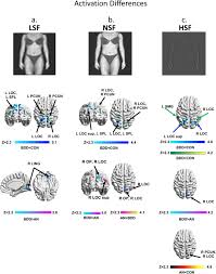 We did not find results for: Brain Activation And Connectivity In Anorexia Nervosa And Body Dysmorphic Disorder When Viewing Bodies Relationships To Clinical Symptoms And Perception Of Appearance Biorxiv