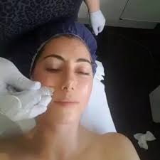 Vampire facial also known as skin needling with factor 4. Four treatments 2  weeks apart. Your blood is taken then the growth factors are separated in  your plasma & massaged into your skin once the ...