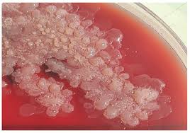 Image result for Rhizobium radiobacter, syn. Agrobacterium tumefaciens