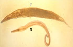 Oxyuris Vermicularis Cacing Kremi Indonesian Medical Laboratory