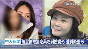 Lyrics for top songs by 蕭淑慎. 20200405ä¸­å¤©æ–°èžè•­æ·'æ…Žç½¹ç™Œ åˆ‡é™¤éƒ¨åˆ†èƒƒè…¸è‡ªå˜† è‡‰éƒ½è®Šå½¢ Youtube