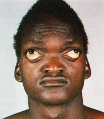 Share the best gifs now >>>. Crazy Eye Black Guy Picture