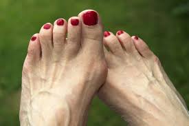 Lay the person flat on his back. Foot Problems People Mistake For A Bunion