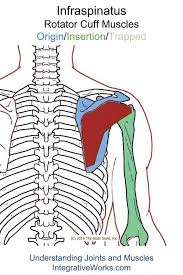 Pin On Shoulder Pain