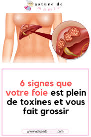 6 Signes Que Votre Foie Est Plein De Toxines Et Vous Fait Grossir Foie Detox Nettoyage Liver Remede Detox Health Hygiene