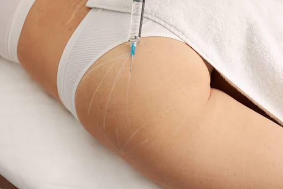 Butt Fillers in Dubai: Enhance, and Lift Without Surgery