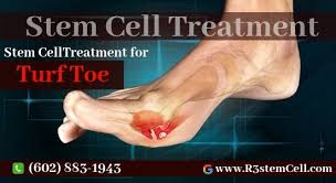 Pin On Foot Disease