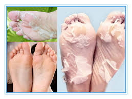 You can try them and maintain make sure to follow the instructions and remove the dead skin properly, if not it can lead to thick skin, formation of warts or corns on the feet. Dead Skin Between Toes Removal Facial Scrub