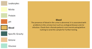 Drugs are ingested and then come out of the system as. Https Www Gla Ac Uk Media Media 678207 Smxx Pdf