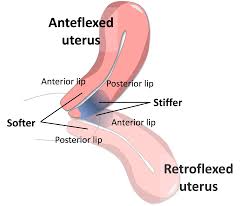 Image result for cervix position