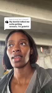 Understanding Dental Veneers: Benefits and Considerations