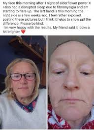 Parsley made me look like I was 20 years old