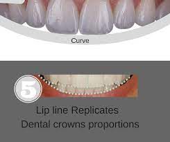 5th Trends In Dental Crowns For Smile Line Area Is Mimic The Curve Of The Lower Lip Line This Gentle Parallel Relatio Dental Crowns Dental Dental Implants