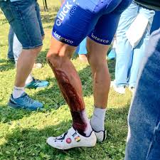 Over a month after the vuelta a burgos feminas the women's worldtour peloton will meet in brest to race the eighth (and potentially last) edition of la course by the tour de france. Cyclists Legs After Tour De France Tourism Company And Tourism Information Center