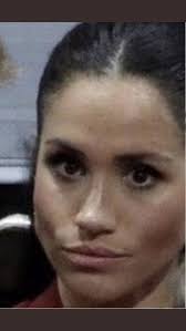 Does young Archie, son of Prince Harry and Meghan Markle, have an inturned  eye? In the few pictures I've seen of him he appears to be cross-eyed.  Prince Edward's older daughter, Lady