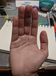 Hello, my hands hand been really sweaty lately and upon closer look there are small pin sized holes in the palm creases. What Does A Freckle On Your Palm Mean Non Dominant Hand Palmistry