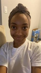 How to get rid of hyperpigmentation and strawberry legs?