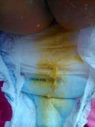 Heces Amarillo Clarito Sera Normal Evolet Casi Con 6 Meses Club Bebes De Enero 2016 Babycenter