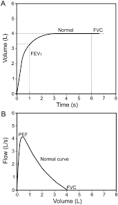 Image result for Pulmonary Function Test Lower Limit of Normal