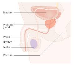 Prostate Cancer Wikipedia