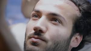 Ricapitolando, l'autotrapianto dei capelli senza rasatura è eseguito da professionisti del settore estremamente competenti e con anni di . Trapianto Di Capelli Senza Rasatura Turchia Istanbul Now Hair Time