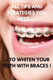 That is, it prepares your teeth to be able to support teeth whitening treatments using some abrasives elements. Pin On Teeth Whitening How To Guides