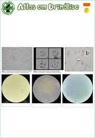 Grátis: Atlas de Urinálise - Material Claro e Objetivo em PDF para Estudo  Rápido