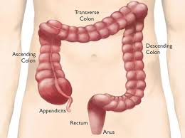 Symptoms of colon cancer and rectal cancer are not always easy to recognize, leading to missed opportunities for early diagnosis. Colorectal Cancer