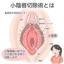 女性器・男性器｜清美会クリニック（福岡・天神）