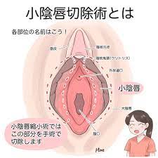 女性器・男性器｜清美会クリニック（福岡・天神）