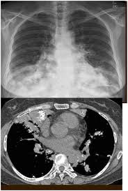 Image result for Incidental Imaging Finding