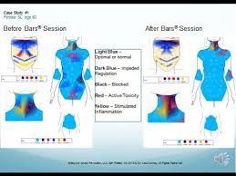 Access Bars And Regulation Thermometry Dr Lisa Cooney And Linda Adamowski Youtube Access Bars Access Consciousness Thermography