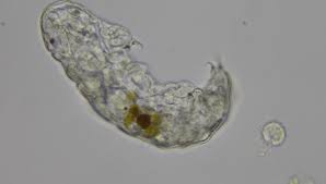 The world looks totally different when seen through the electron microscope. What Are Tardigrades Tardigrades Under A Microscope Microscope Clarity