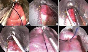Annals of Coloproctology