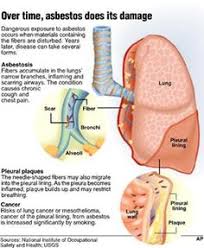 About 80% of people with mesothelioma have been exposed to asbestos. 30 Mesothelioma Draft Ideas Mesothelioma Cancer Lunges