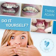 Even if you are not yet at a stage of life where you might need braces, how straight your parents' teeth are can be a good indication as to whether or not you might get braces yourself. Ssdc Dental No To D I Y Braces And Fashion Braces Facebook